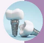 Центр имплантации и стоматологии «Стеллит» осуществляет широкий комплекс стоматологических услуг в Санкт-Петербурге.  Наши основные направления деятельности:  
- имплантация зубов;  
- терапия и леч ...