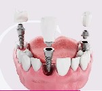 Стоматология Dental Luxury Clinic осуществляет широкий спектр стоматологических услуг в Москве.  Наши клиники оснащены ультрасовременным оборудованием.  Основные услуги:  
- лечение зубов под общей а ...