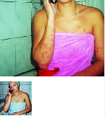 Нетрадиционная медицина объявление но. 1013487: Распространенный псориаз