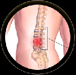 Инновационный пояс, помогающий вернуть здоровье суставам и восстановить хрящевую ткань. Лечит артрит, артроз и остеохондроз, запускает процесс регенерации суставов в кратчайшие сроки. ...