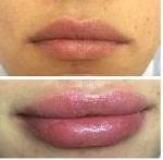 Здравствуйте! Спешу предложить вам услуги ЭЛОС ЭПИЛЯЦИИ И КОСМЕТОЛОГИИ!!! По весьма приятным ценам. 

Лазерная ELOS-эпиляция
Инъекционная и аппаратная косметология

Меня зовут Алёна и я врач косм ...