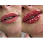 Грузоперевозки, переезды, грузчики объявление но. 1818110: Косметолог в центре города