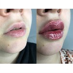 Грузоперевозки, переезды, грузчики объявление но. 1818110: Косметолог в центре города