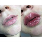 Грузоперевозки, переезды, грузчики объявление но. 1818110: Косметолог в центре города