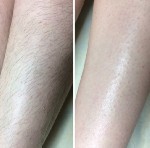 Салоны красоты объявление но. 1822456: Шугаринг