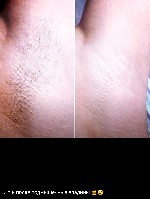 Салоны красоты объявление но. 2742671: Мужская и женская депиляция,  шугаринг