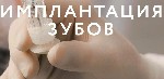 Операция проходит под местной анестезией,  и полностью безболезненная.  После операции может быть небольшой дискомфорт и отек,  который купируется с помощью обезболивающих.  Швы снимаются на 10-14 сут ...