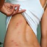 Разное объявление но. 976616: МЫТИЩИ СРЕДСТВО от клопов тараканов и всех насекомых для уничтожения в квартире офисе на даче гарантия